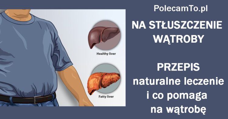 PolecamTo.pl-stuszczenie-watroby-sposoby-domowe